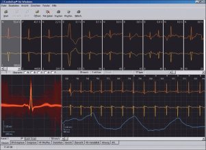 Система холтеровского мониторирования ЭКГ CardioDay