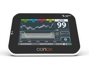Монитор Conox для оценки глубины анестезии