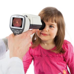 Камера цифровая офтальмологическая Smartscope PRO