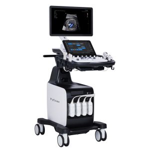 УЗИ аппарат РуСкан 75M